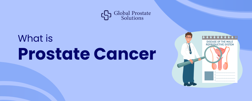 What is Prostate Cancer