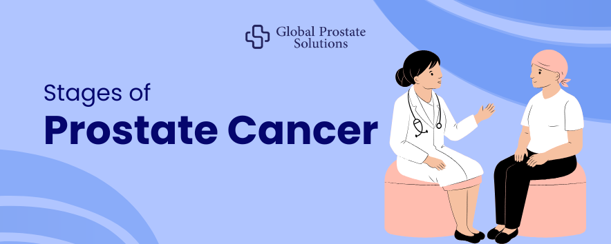 Stages of Prostate Cancer