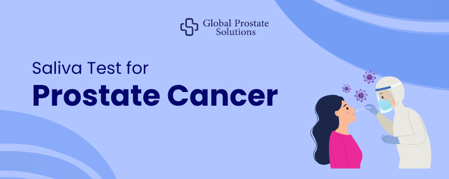 Saliva Test for Prostate Cancer