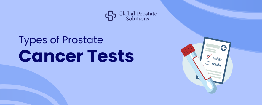 Types of Prostate Cancer Tests