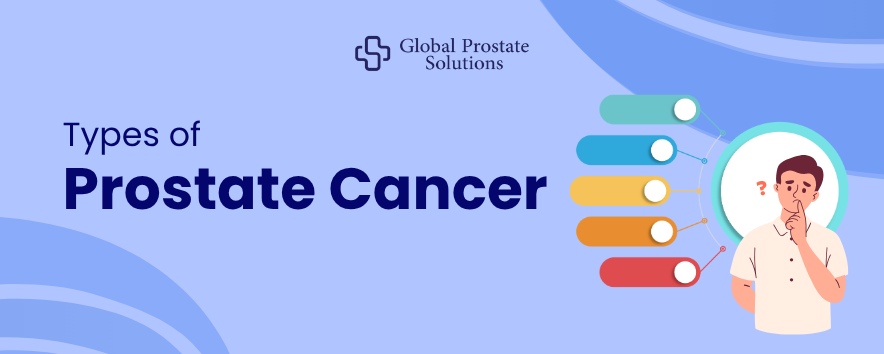 Types of Prostate Cancer