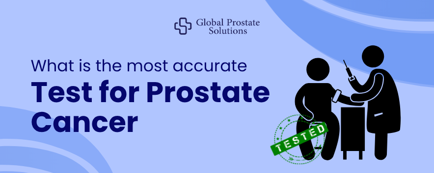 What is the most accurate Test for Prostate Cancer​