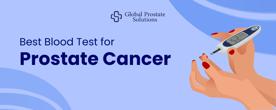 Best Blood Test for Prostate Cancer: PSA Blood Test