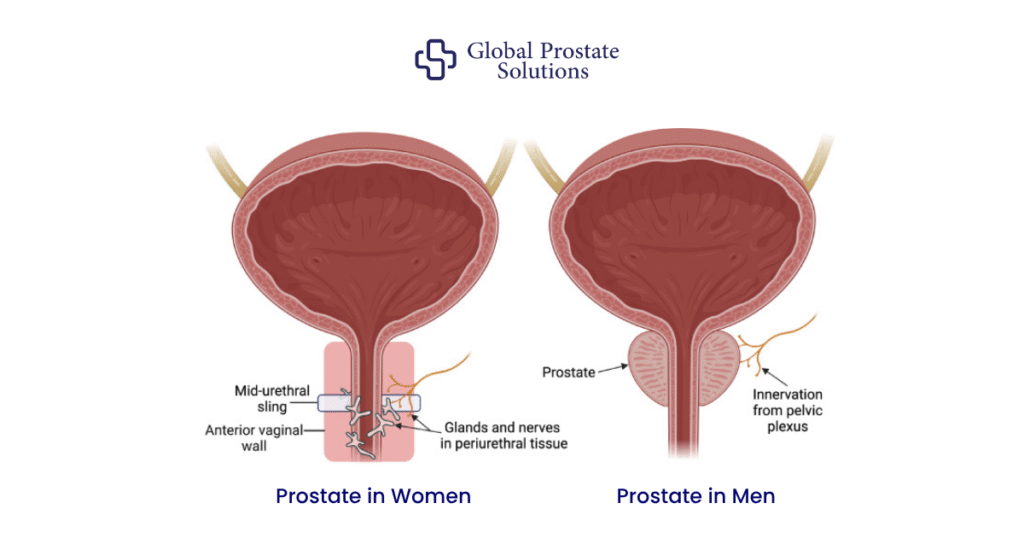Can Women Get Prostate Cancer