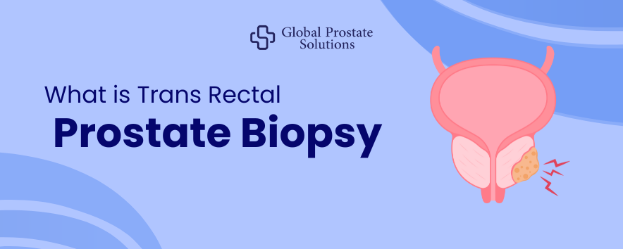 What is Transrectal Prostate Biopsy