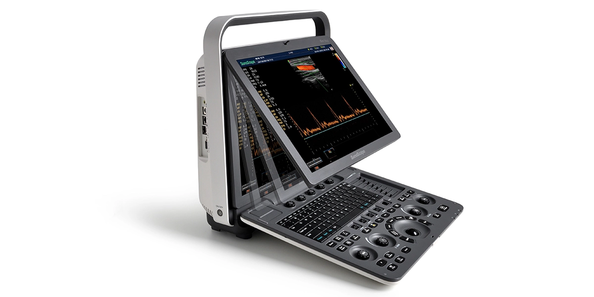 S8 portable ultrasound system