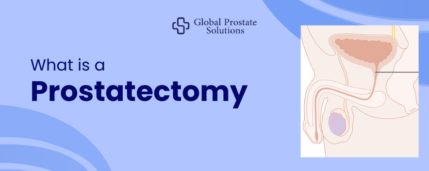 What is a Prostatectomy