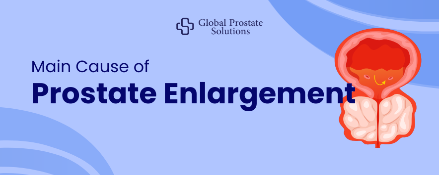What is the Main Cause of Prostate Enlargement