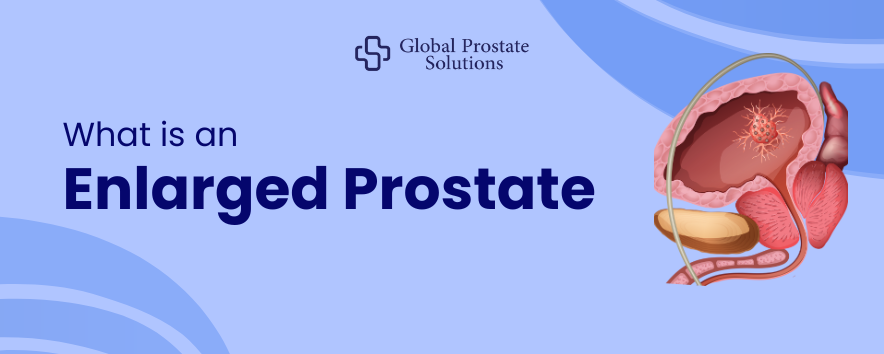 What is an Enlarged Prostate