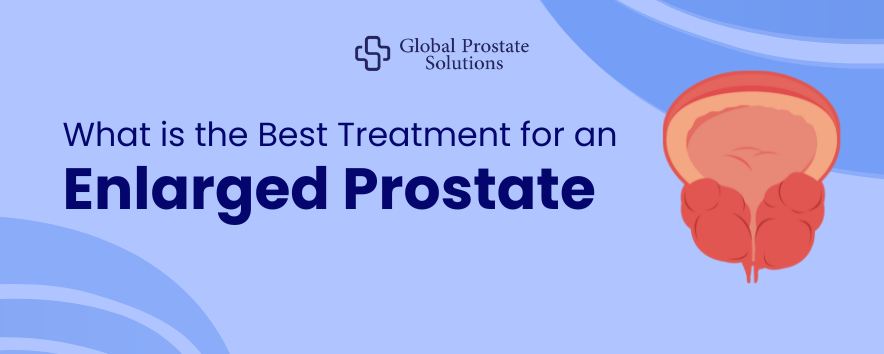 What is the Best Treatment for an Enlarged Prostate