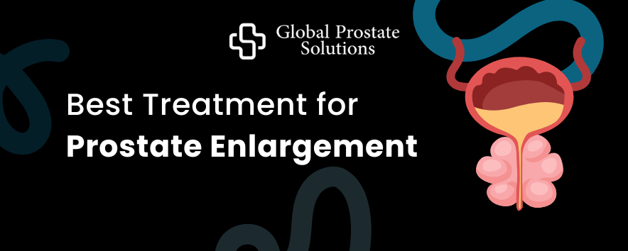 What is the Best Treatment for Prostate Enlargement