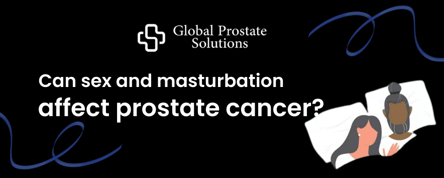 Can sex and masturbation affect prostate cancer