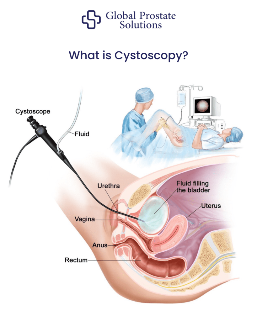 What is Cystoscopy