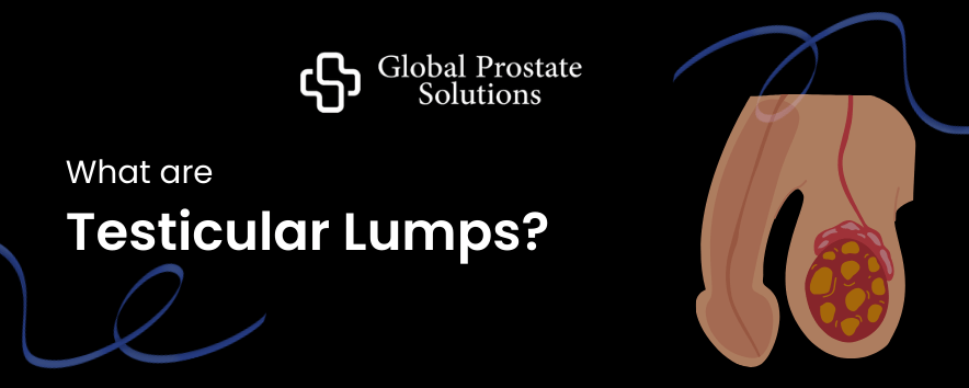 What are Testicular Lumps