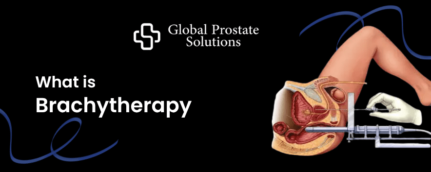 What is Brachytherapy